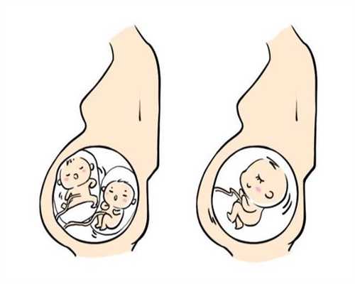 上海人工受孕多少钱：婴儿出生时被发现长有“
