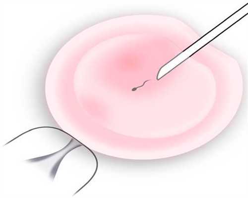 上海不孕不育手术：孕妇能接触X线吗关于怀孕期