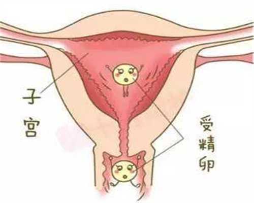 上海不孕不育代怀孕：孕妇吃降血糖呢