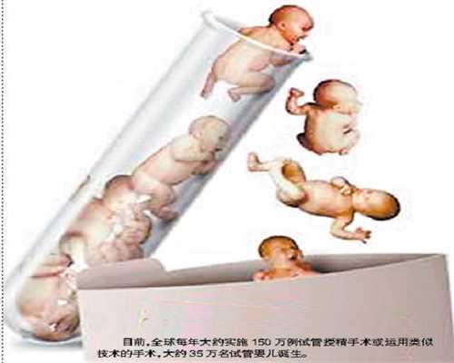 上海 不孕不育 中医：孕期也可以运动，有人在怀