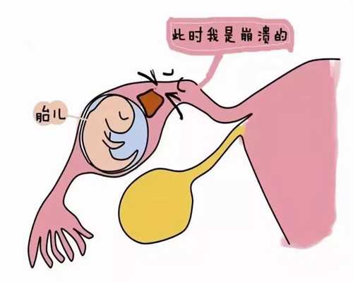 香港试管婴儿：怀孕有多辛苦五张图带你看看孕