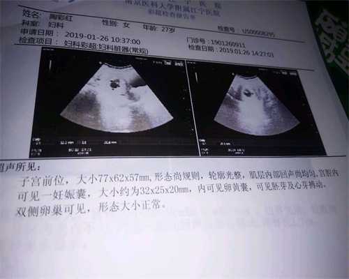 广州有哪些代怀孕机构：怀孕五十天胎停怎么办