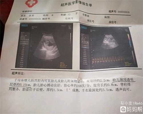 广州助代怀孕包男孩：胎盘低置后壁是男孩吗