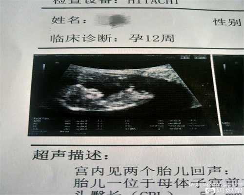广州试管哪个医院好：怀孕尿检检查的是什么