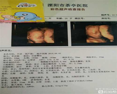 广州代孕医生咨询_怀双胞胎要做更多次B超检查吗