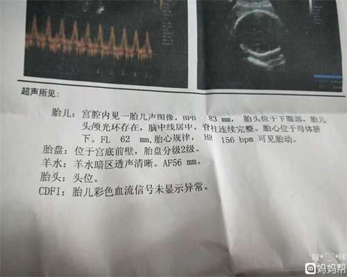 广州代孕怎么样_顺产时一些让人心疼的助产措施