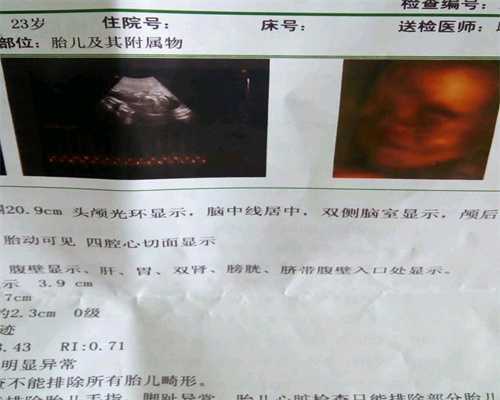 广州代孕靠谱吗_常见的孕期母婴溶血情况该怎么