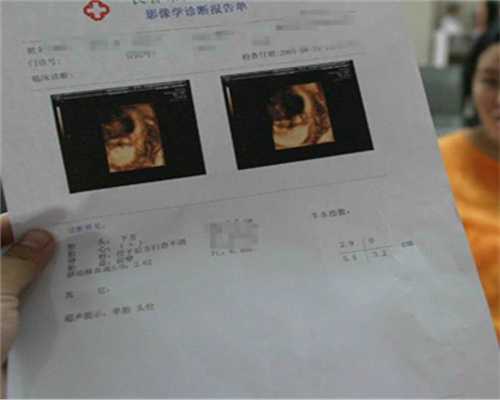 广州代孕网_怀孕五个月胎停几率是多大
