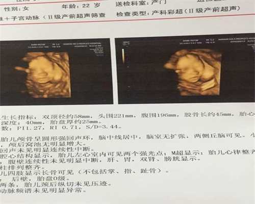 广州代孕中心_怀孕五个月脐带绕颈一周怎么办