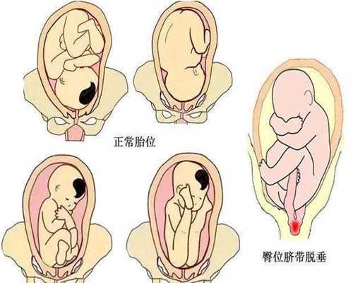 广州代孕包男孩_胎心率170顺产有危险吗