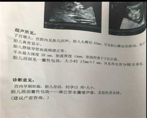 广州代孕在哪里_5A认证代孕网_代孕全包多少钱