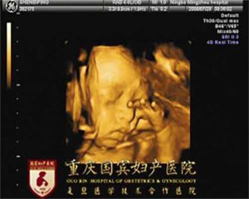 广州代孕怎么样_代孕生子的价格是多少_代怀一个