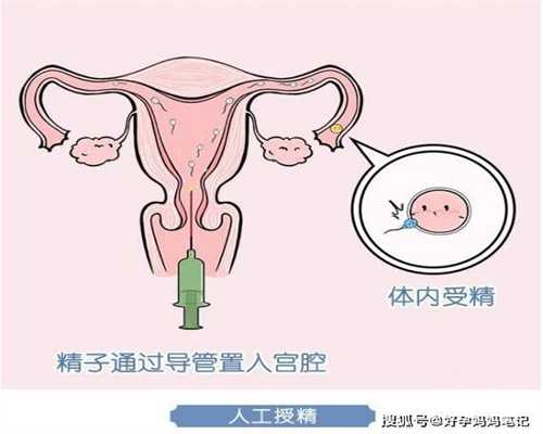 广州代孕要求,去广州代孕费用多少,广州借卵做试管代孕成功率高吗
