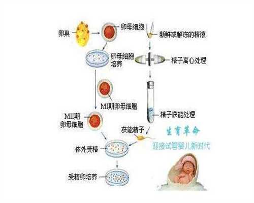 广州代孕方法,广州代孕价格表查询,广州做试管女月经都检查什么