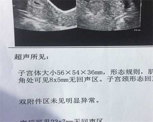 广州出生证代孕,广州合法的代孕价格在哪里【不孕有好孕，广州代孕网助怀孕