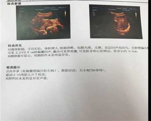 广州助孕产子中心-幼儿早期教育的几个类型