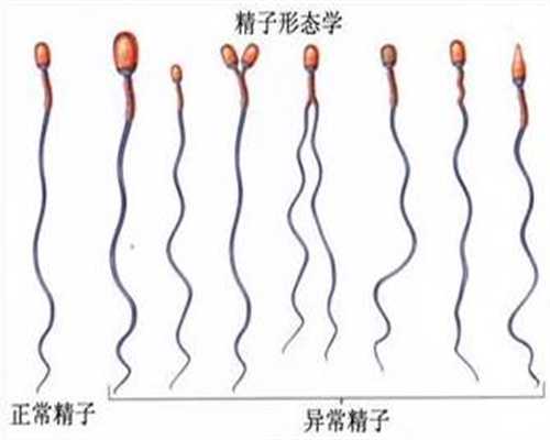 广州代孕包儿子_代孕生殖中心_正规的代孕包成功