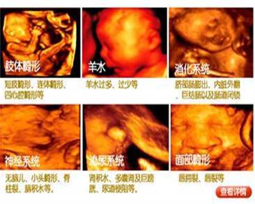 广州代孕包性别_代孕哪家安全_哪里有代孕的医院