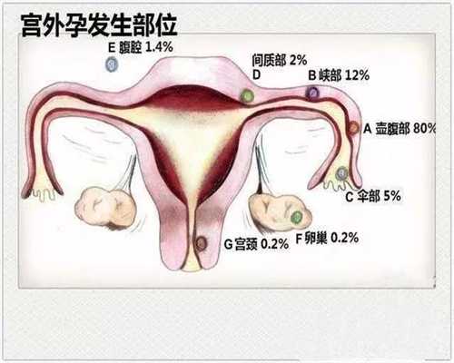 广州北医三院供卵-代孕地址_试管婴儿过程中女性卵泡不成熟该怎么办？