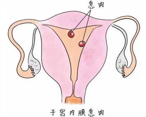 广州代孕小孩-那一家做代孕权威_高血压女性试管助孕的注意事项