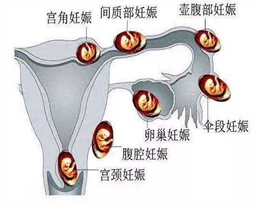 代孕供卵多少钱-广州医院供卵_霉菌性阴道炎是怎么引起的？如何治疗？