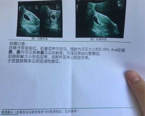 广州找靠谱代孕-代孕代孕妈妈_男性备孕期注意事项怀孕心理准备