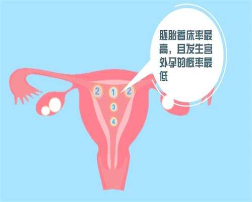 试管加代孕哪家-广州代孕过程全方位保密_试管婴儿禁忌人群有