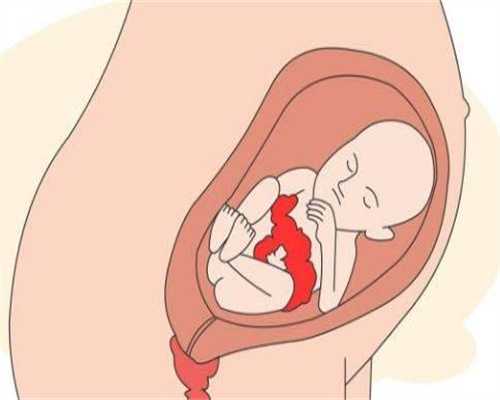 代孕做要多少钱-广州哪里找代孕_输卵管积能采用泰国试管婴儿助孕吗输卵管完