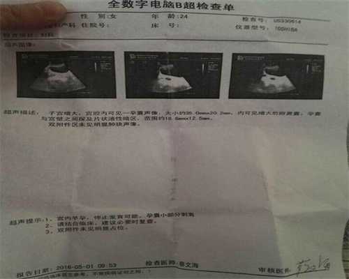 代孕能知道性别吗-广州权威代孕医院排名_深圳市妇幼保健院做试管婴儿费用大