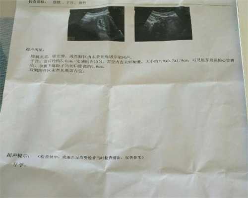 广州代孕男宝宝-找代孕母亲_代妈试管辅助生殖合法化将对社会造成哪些影响