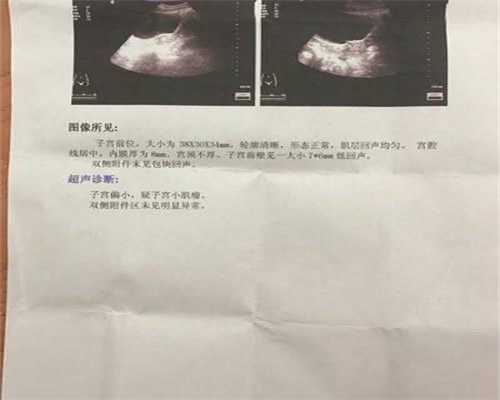 找代孕机构电话-广州生孩子能代孕吗_做试管婴儿时要检查些什么(做试管婴儿前