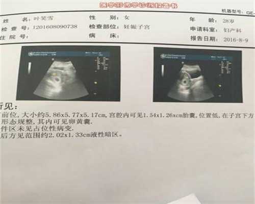 试管代孕包出生-广州代孕生儿子多少钱_如何避免做试管婴儿时引起的并发症