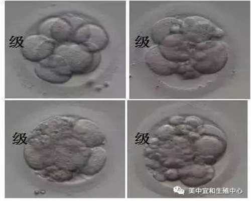 广州试管代孕的成功率怎么样-金贝供卵联系方式_流产、胎停多久以后可以开始