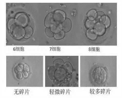 广州艾滋病患者代孕-靠谱的代孕机构价格_保护精子有哪些要注意？做试管婴儿