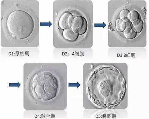 代孕产子技术介绍-广州代孕妈妈_试管婴儿检查流程，看专家怎样建议？