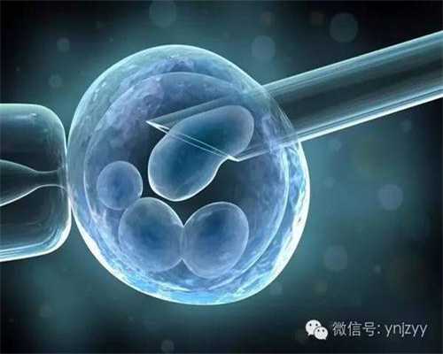 广州代孕怎么上户口-代孕现在需要多少钱_实拍取卵全过程（附图），近距离了