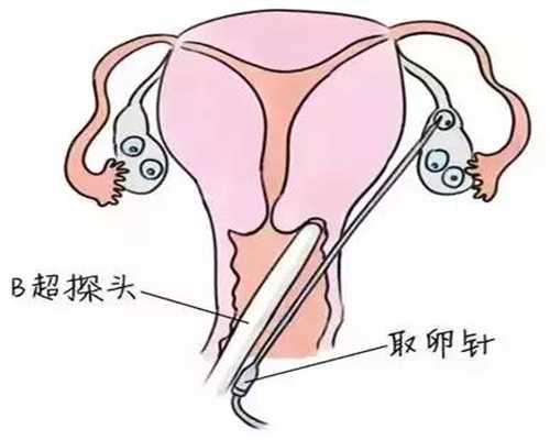 代孕全过程的流程介绍-广州代孕怎么选择性别_美国代孕：美宝回国该办哪些证